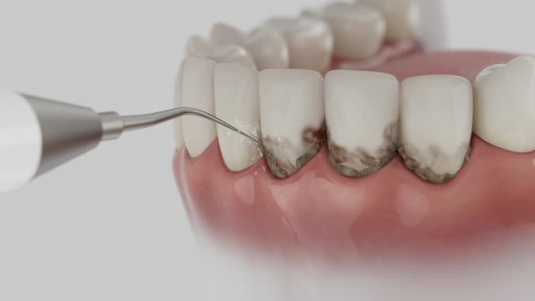 Reliable Dental contractor in Coudersport, PA by Dentist Open Now